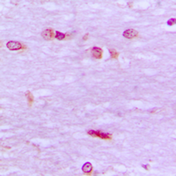 Anti-BRF1 antibody used in IHC (Paraffin sections) (IHC-P). GTX55860