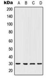 Anti-HOXC12 antibody used in Western Blot (WB). GTX55862