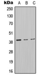 Anti-MT-ND2 antibody used in Western Blot (WB). GTX55870
