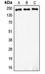 Anti-MYH8 antibody used in Western Blot (WB). GTX55871