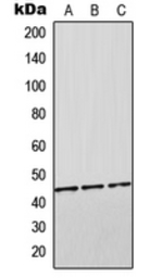 Anti-Orosomucoid 2 antibody used in Western Blot (WB). GTX55874