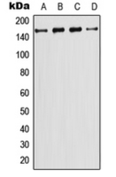 Anti-PI3 kinase C2 gamma antibody used in Western Blot (WB). GTX55876