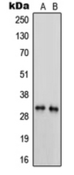 Anti-PRSS3 antibody used in Western Blot (WB). GTX55883