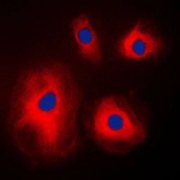 Anti-RPS4X antibody used in Immunocytochemistry/ Immunofluorescence (ICC/IF). GTX55889