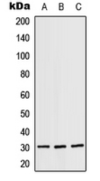 Anti-RPS4X antibody used in Western Blot (WB). GTX55889