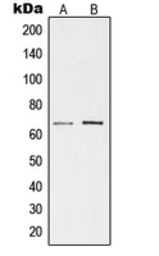 Anti-TESK1 antibody used in Western Blot (WB). GTX55897