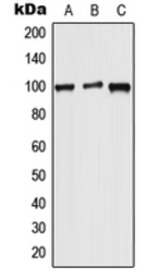Anti-WFS1 antibody used in Western Blot (WB). GTX55899