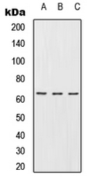 Anti-RMP antibody used in Western Blot (WB). GTX55904
