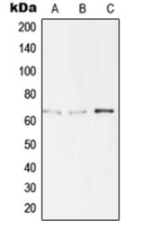 Anti-TBX15 + TBX18 antibody used in Western Blot (WB). GTX55908