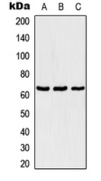 Anti-TBX18 antibody used in Western Blot (WB). GTX55909