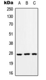 Anti-RAB33A antibody used in Western Blot (WB). GTX55915
