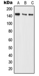Anti-BMS1 antibody used in Western Blot (WB). GTX55918