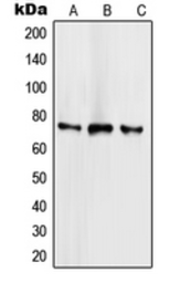 Anti-SCML2 antibody used in Western Blot (WB). GTX55921