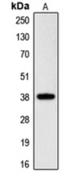 Anti-CGR19 antibody used in Western Blot (WB). GTX55925