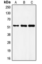 Anti-FRS3 antibody used in Western Blot (WB). GTX55928