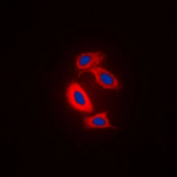 Anti-RAB31 antibody used in Immunocytochemistry/ Immunofluorescence (ICC/IF). GTX55929