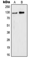 Anti-WDHD1 antibody used in Western Blot (WB). GTX55930
