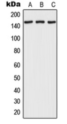 Anti-RPAP1 antibody used in Western Blot (WB). GTX55944