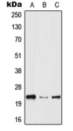 Anti-HPGDS antibody used in Western Blot (WB). GTX55947
