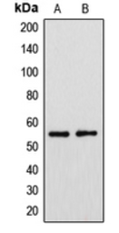 Anti-CYP39A1 antibody used in Western Blot (WB). GTX55952