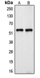 Anti-CYP39A1 antibody used in Western Blot (WB). GTX55953