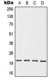 Anti-OAZ3 antibody used in Western Blot (WB). GTX55956