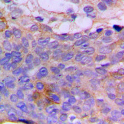 Anti-CSGALNACT1 antibody used in IHC (Paraffin sections) (IHC-P). GTX55962