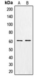 Anti-CSGALNACT1 antibody used in Western Blot (WB). GTX55962