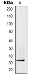 Anti-PMEPA1 antibody used in Western Blot (WB). GTX55966
