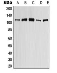 Anti-SLC4A9 antibody used in Western Blot (WB). GTX55974
