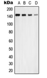 Anti-USP42 antibody used in Western Blot (WB). GTX55977