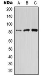 Anti-PI3 kinase p87 antibody used in Western Blot (WB). GTX55983