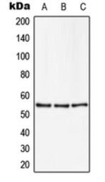 Anti-ZSCAN22 antibody used in Western Blot (WB). GTX55990