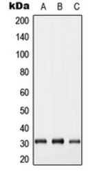 Anti-GJB5 antibody used in Western Blot (WB). GTX55992