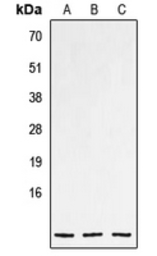Anti-CNP antibody used in Western Blot (WB). GTX55996