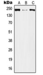 Anti-Plexin A2 antibody used in Western Blot (WB). GTX55998