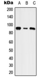 Anti-SLC9A5 antibody used in Western Blot (WB). GTX56000