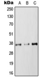 Anti-RAB36 antibody used in Western Blot (WB). GTX56003