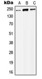 Anti-MORF antibody used in Western Blot (WB). GTX56004