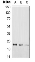 Anti-RAB39A antibody used in Western Blot (WB). GTX56008