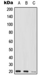 Anti-MED9 antibody used in Western Blot (WB). GTX56009