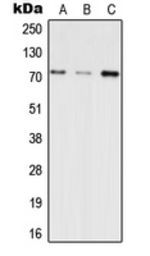 Anti-INPP5E antibody used in Western Blot (WB). GTX56011