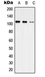 Anti-USP35 antibody used in Western Blot (WB). GTX56013