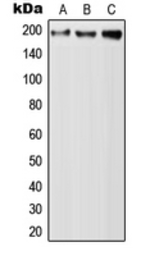 Anti-QSER1 antibody used in Western Blot (WB). GTX56015