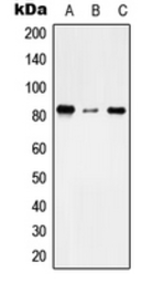Anti-TMC7 antibody used in Western Blot (WB). GTX56016