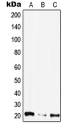 Anti-CIB4 antibody used in Western Blot (WB). GTX56020