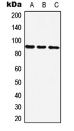 Anti-ZNF25 antibody used in Western Blot (WB). GTX56022