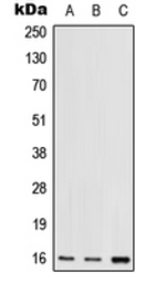 Anti-RPS17 antibody used in Western Blot (WB). GTX56024