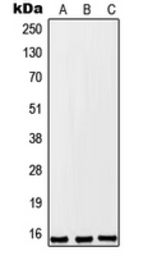 Anti-TPT1P8 antibody used in Western Blot (WB). GTX56026
