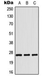 Anti-COL4A3 antibody used in Western Blot (WB). GTX56029